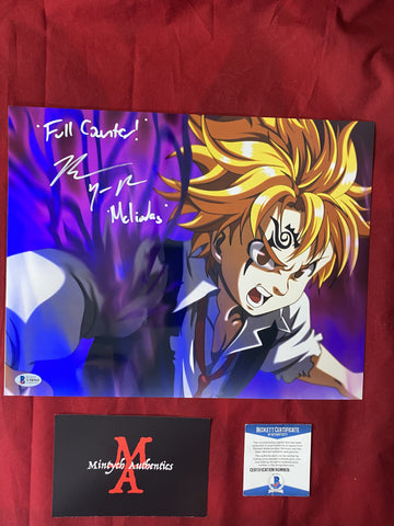 BRYCE_103 - 11x14 Metallic Photo Autographed By Bryce Papenbrook